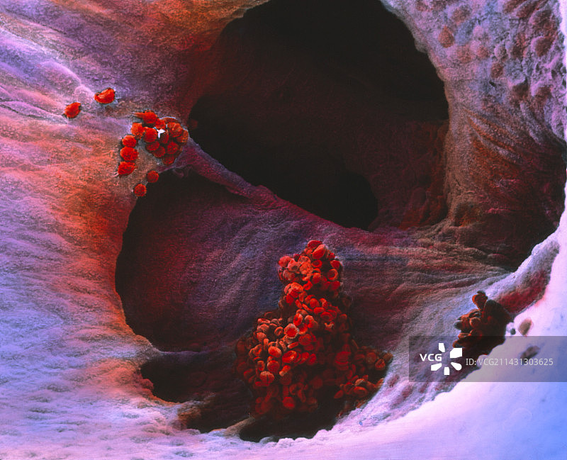 心脏内血栓的伪彩色扫描电镜图片素材
