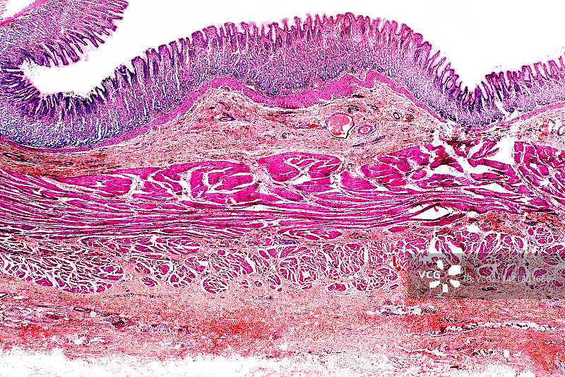 胃壁浅显微照片图片素材