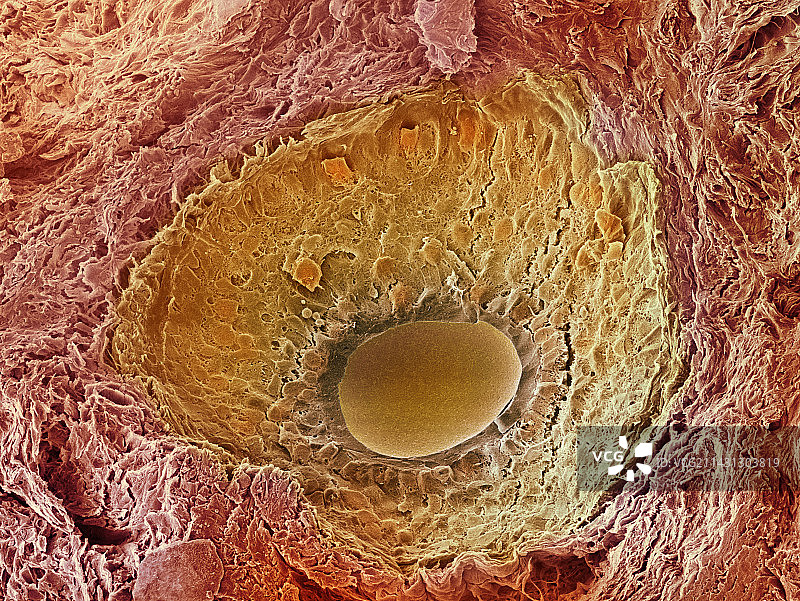 卵巢卵泡扫描电镜图片素材