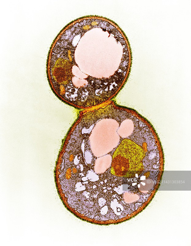 酵母菌萌芽，TEM图片素材