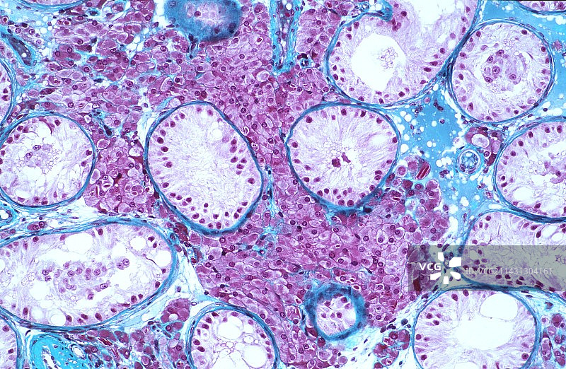 人类睾丸显微照片图片素材