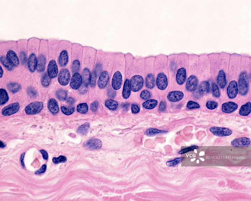 假复层柱状上皮细胞显微照片图片素材
