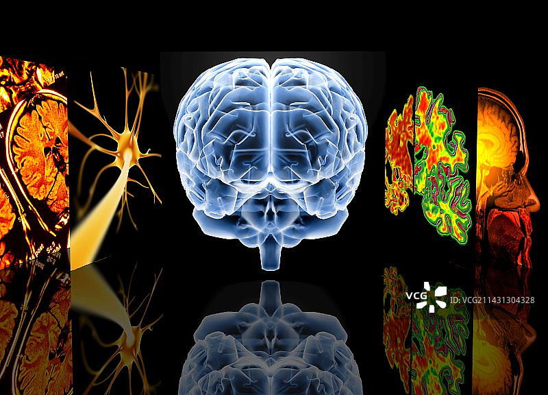 神经病学图片素材