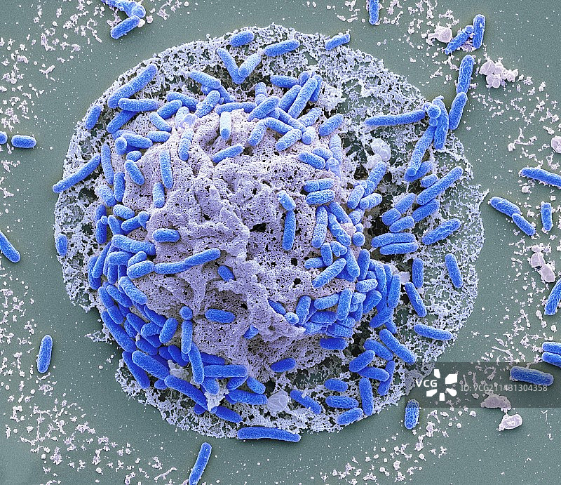 大肠杆菌诱导细胞死亡扫描电镜图图片素材