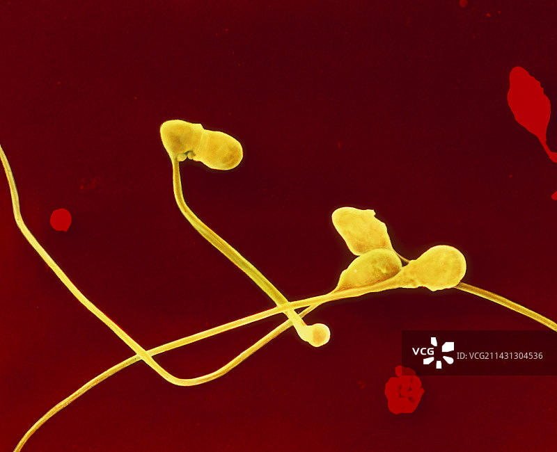 彩色扫描电镜下的畸形精子图片素材