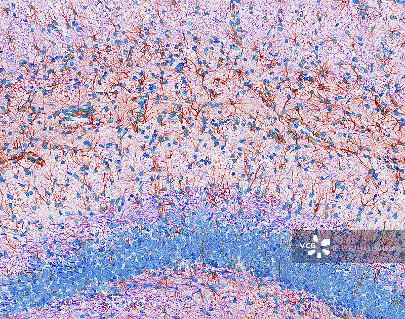 海马脑组织图片素材