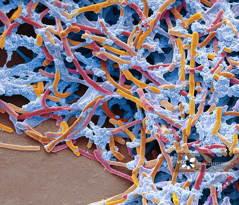 放线菌病扫描电镜图图片素材