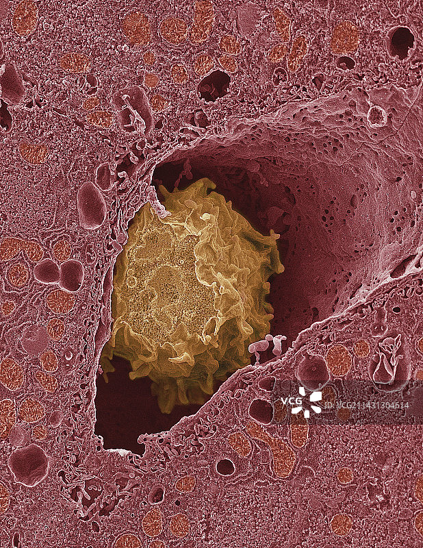 肝脏巨噬细胞，扫描电子显微镜图片素材