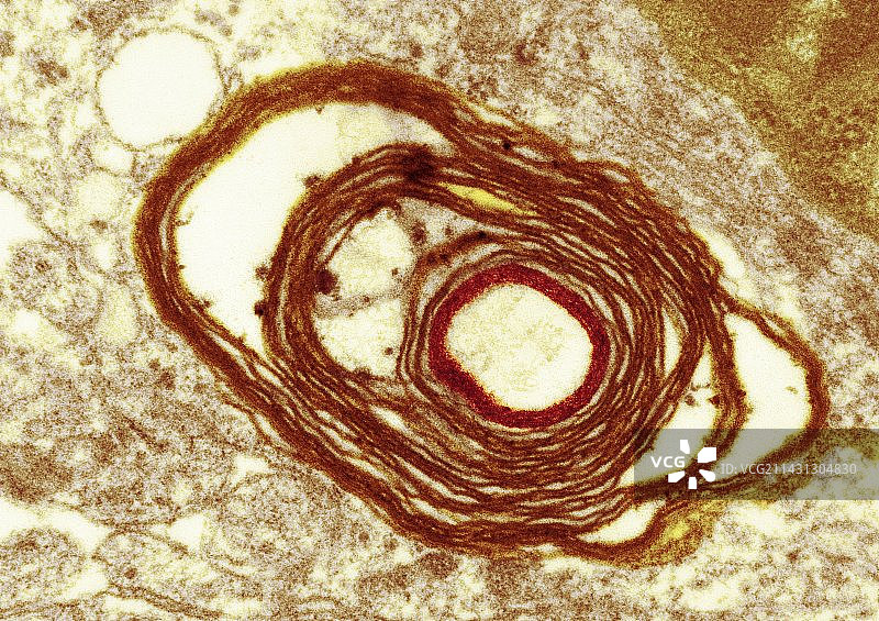神经轴突周围的髓磷脂，透射电子显微镜图片素材