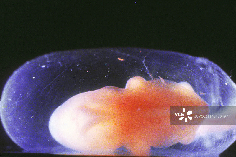 8周的胎龄图片素材