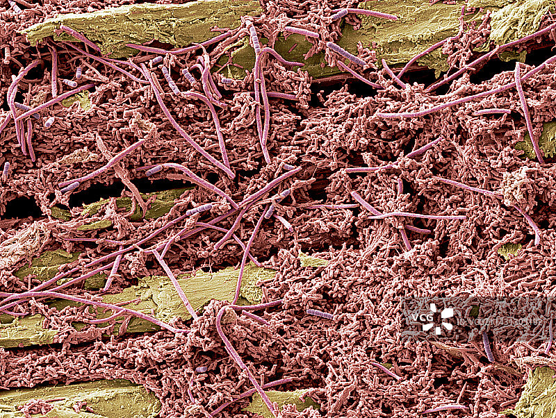 牙菌斑扫描电镜图图片素材