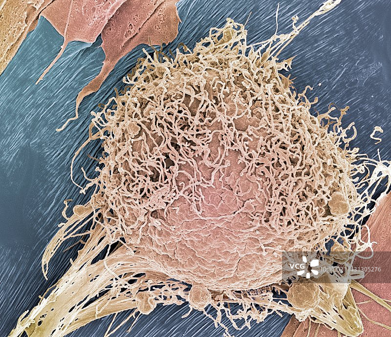 骨髓干细胞扫描电镜图图片素材