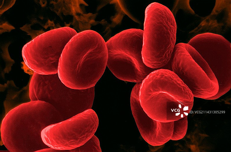 低渗溶液中的红细胞扫描电镜图图片素材