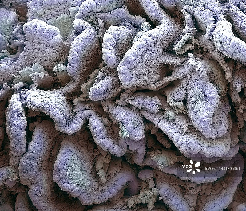 肠绒毛，扫描电子显微镜图片素材