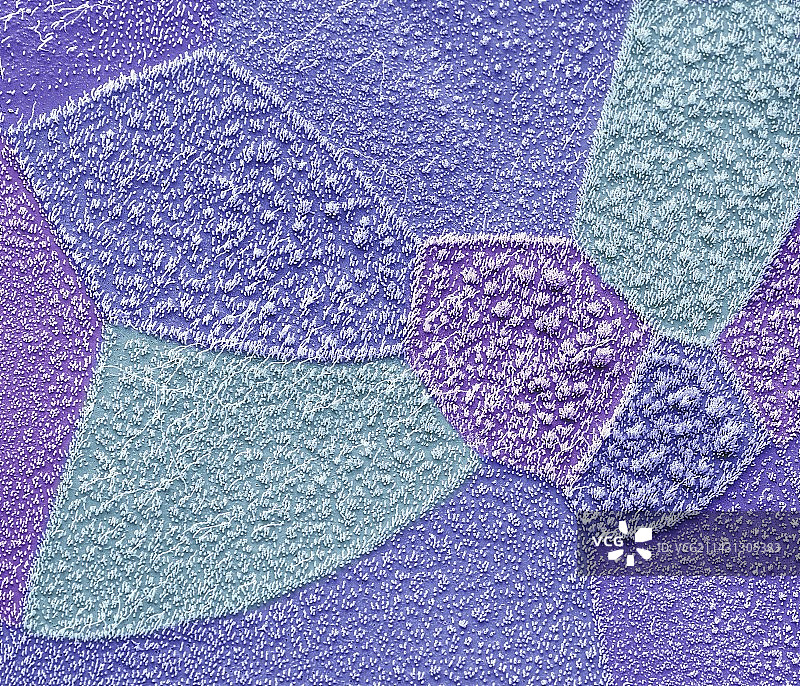 支气管上皮细胞扫描电镜图图片素材