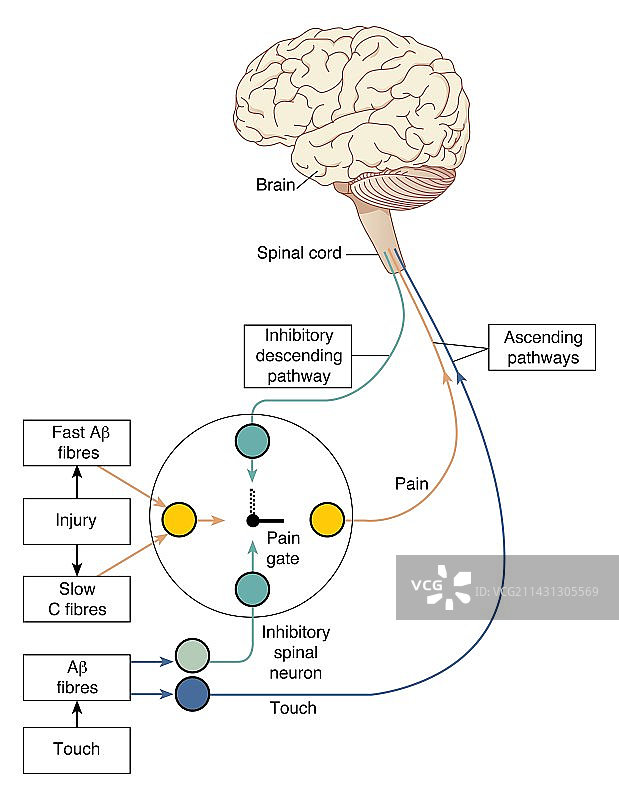 疼痛的闸门控制理论，艺术作品图片素材