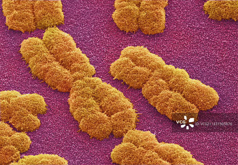 人类染色体，扫描电镜图图片素材