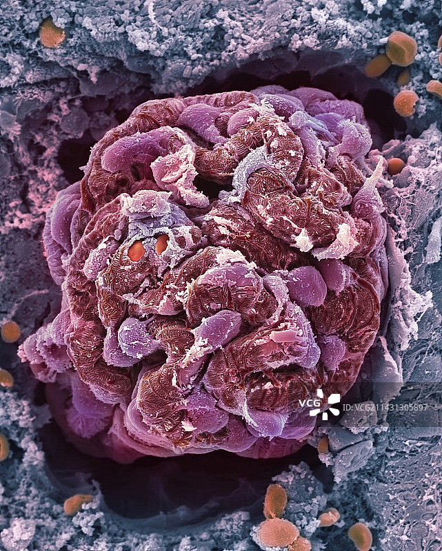 肾小球扫描电镜图图片素材