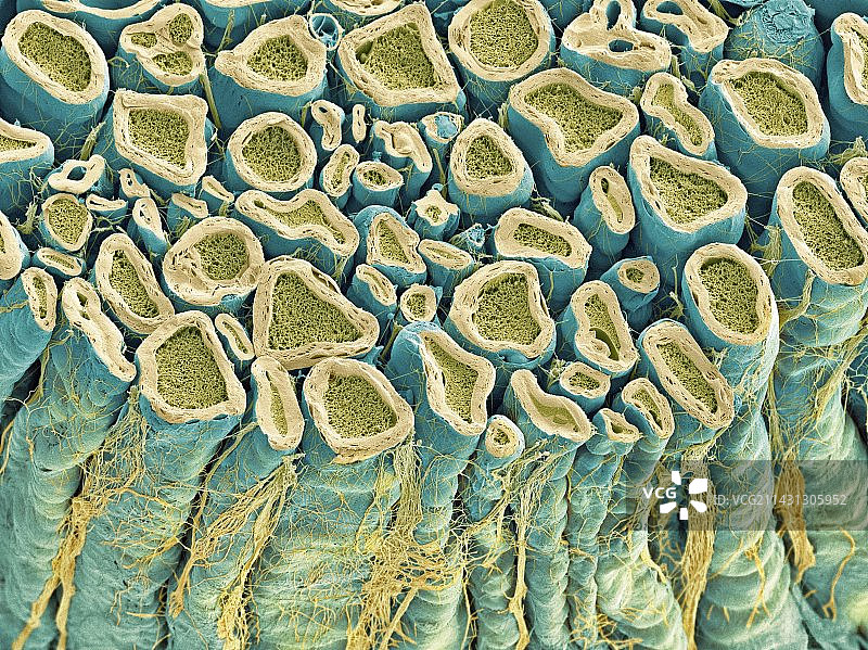 脊神经根扫描电镜图图片素材