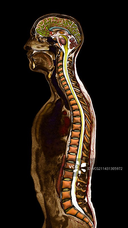头部和躯干矢状MRI图片素材