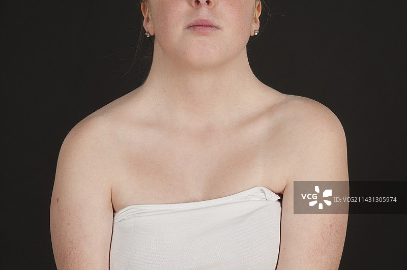 特纳综合征图片素材