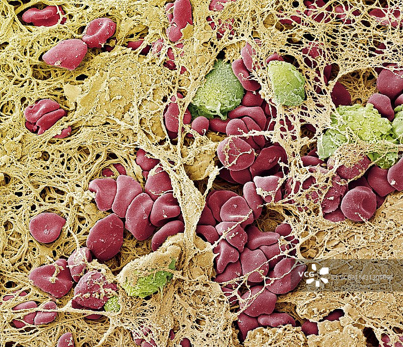 血栓扫描电镜图片素材