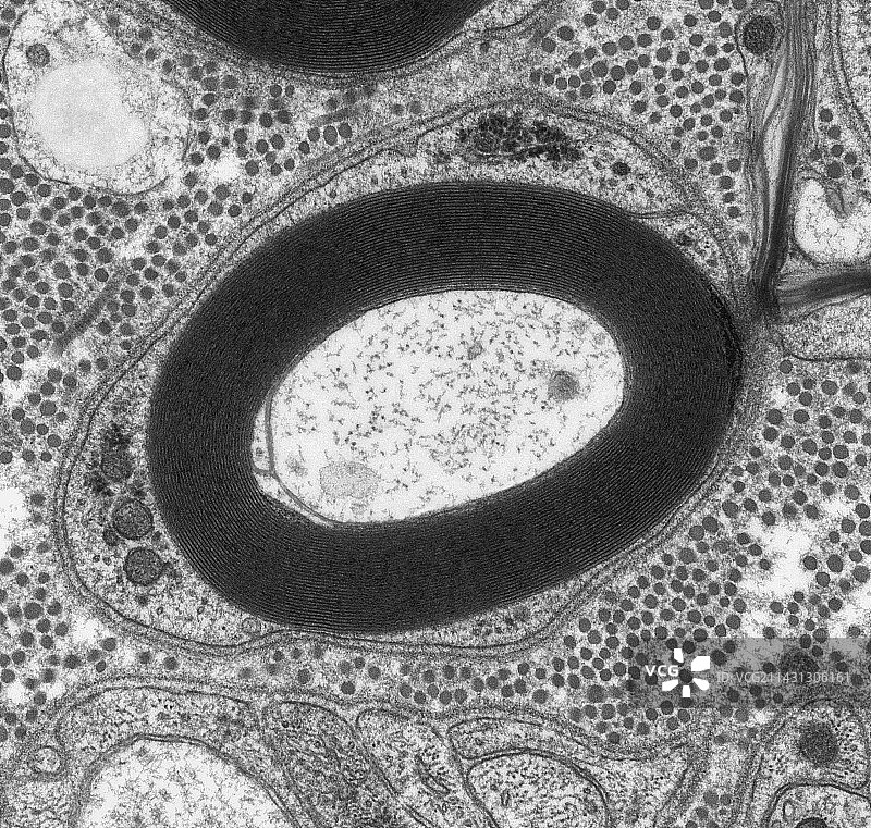 髓鞘神经TEM图片素材