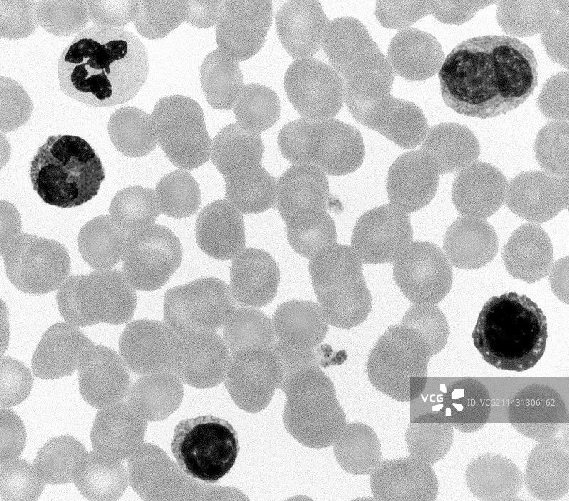 血涂片，光学显微照片图片素材
