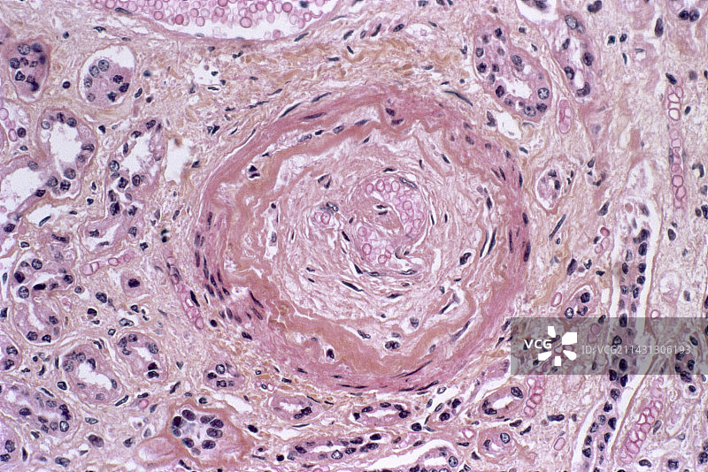 硬皮病光显微照片图片素材