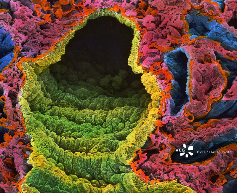 肺泡的扫描电子显微镜图像图片素材