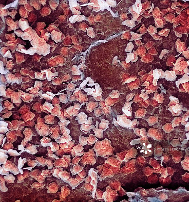 皮肤表面扫描电镜图图片素材