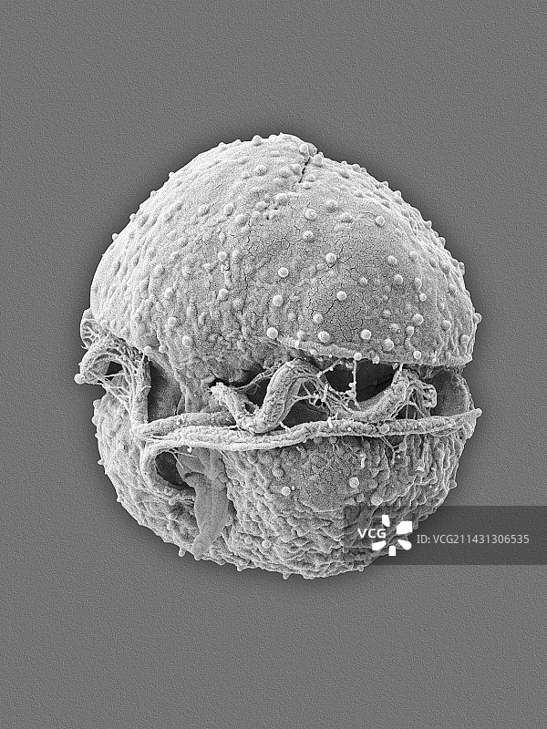 食鱼性费斯特菌（扫描电镜）图片素材