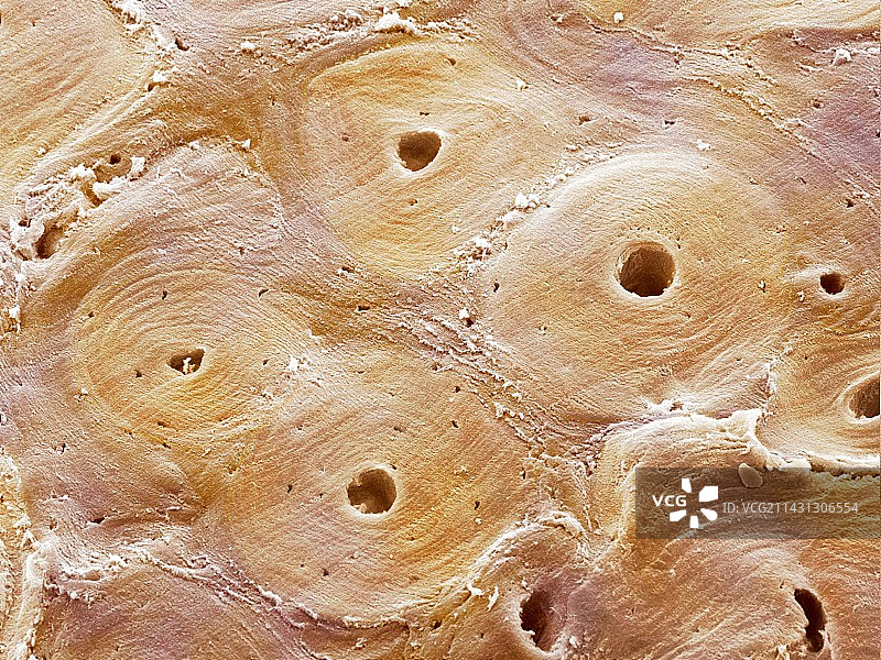 致密骨图片素材