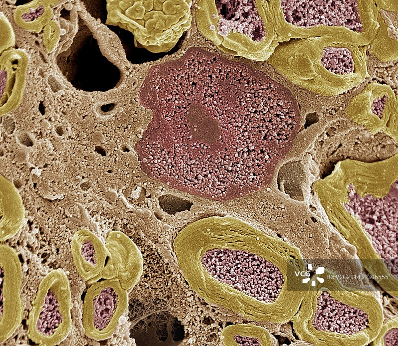 周围神经，扫描电镜图像图片素材