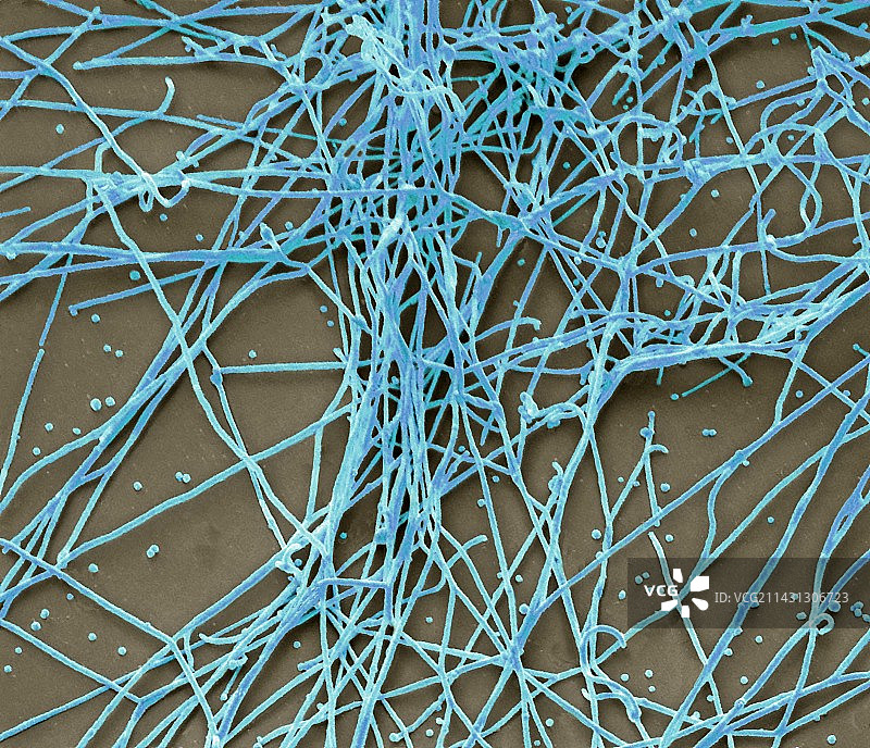 H1N1流感病毒株，扫描电子显微镜图片素材