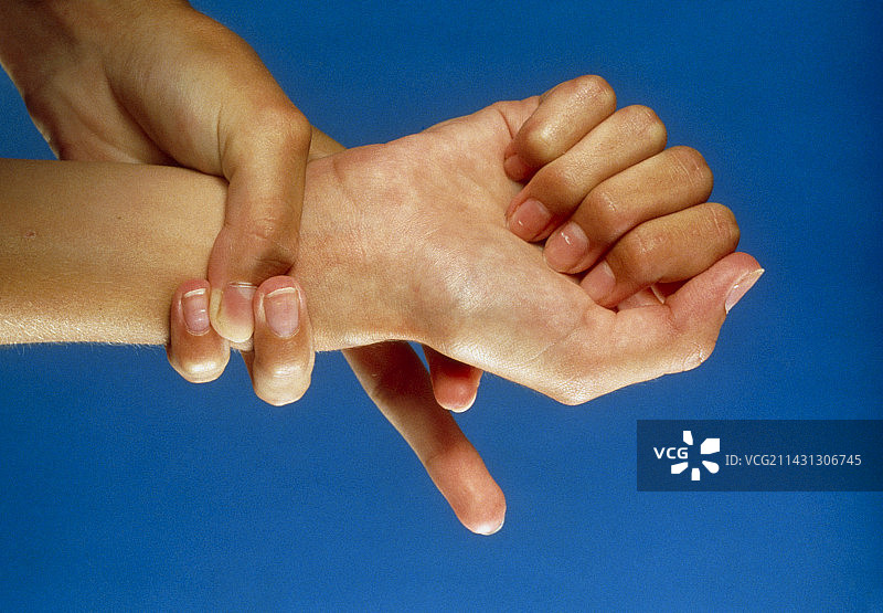 马凡综合征：关节松弛和手指细长图片素材