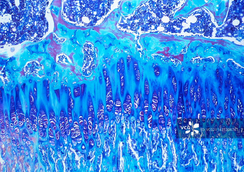 骨骼形成图片素材