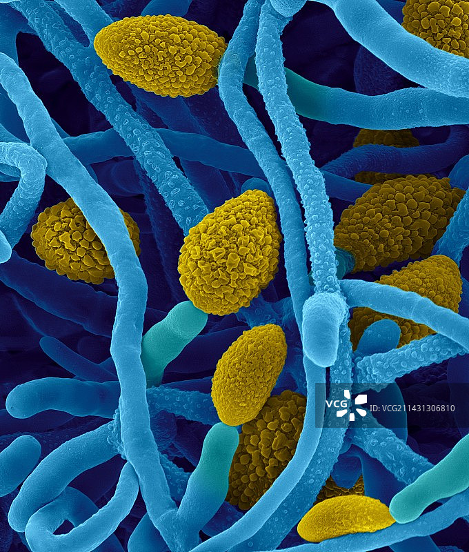 炭黑葡萄孢菌的孢子囊，扫描电镜图片素材