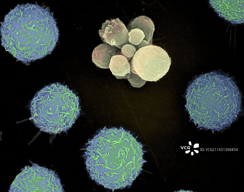 细胞死亡扫描电镜图图片素材