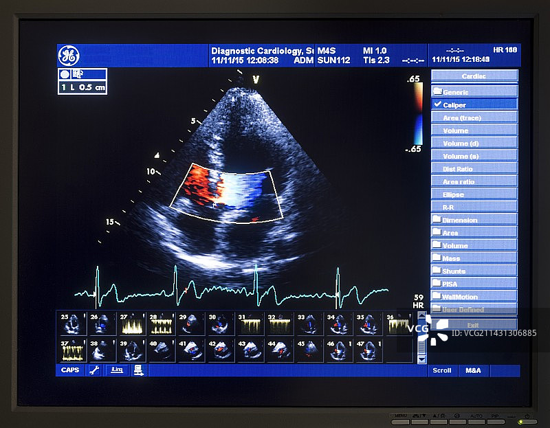 多普勒超声心动图扫描图片素材