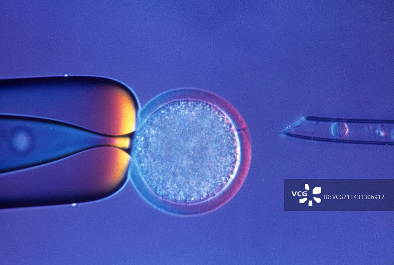 绵羊克隆过程中卵细胞和乳腺细胞的光学显微镜图像图片素材
