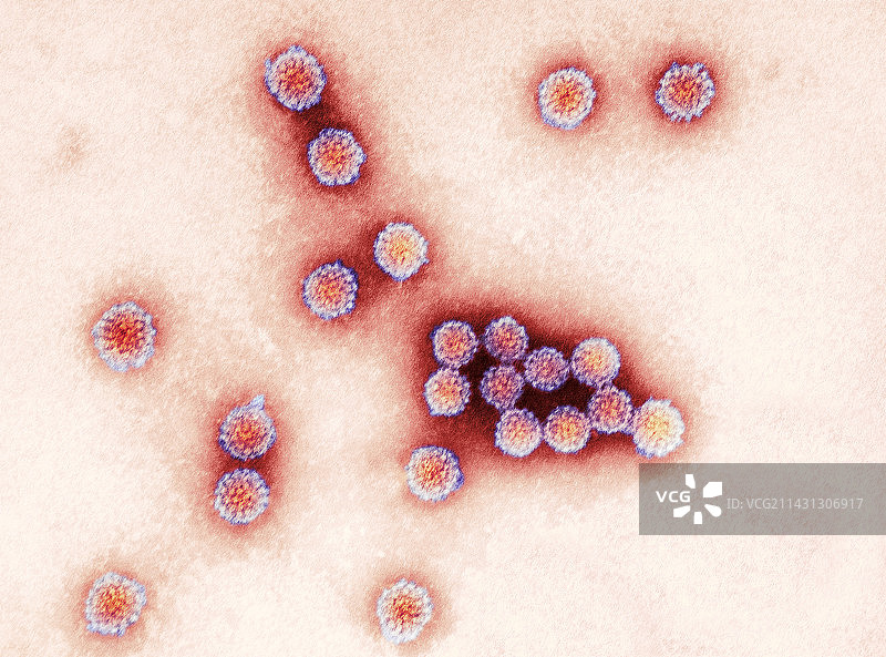 乳头瘤病毒颗粒，透射电镜图片素材
