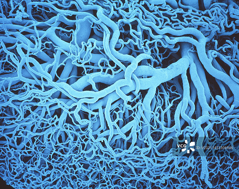 淋巴管，扫描电镜图片素材