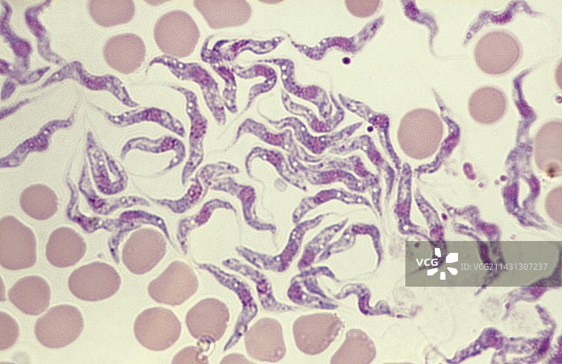 昏睡病血涂片图片素材