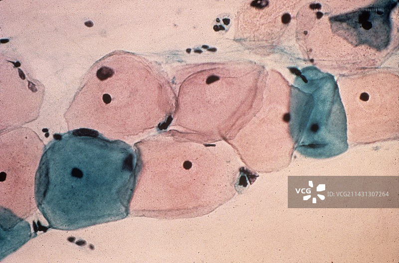 健康的宫颈涂片，显微照片图片素材