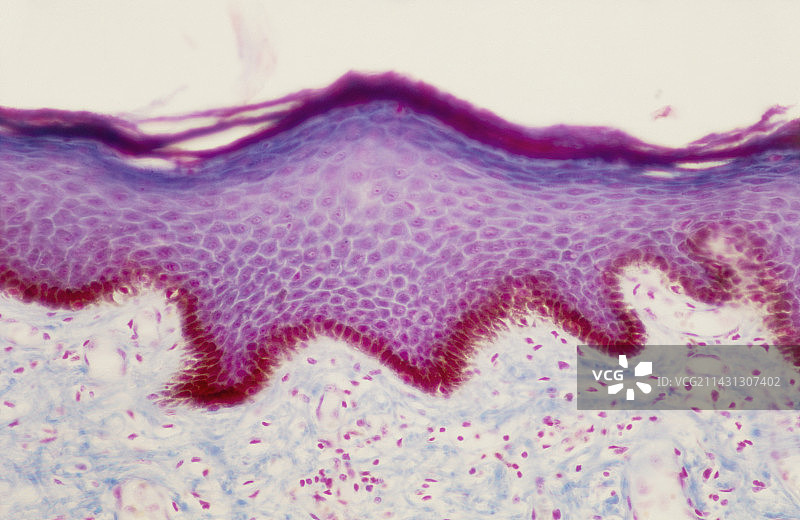 黑色皮肤切片的光学显微照片图片素材