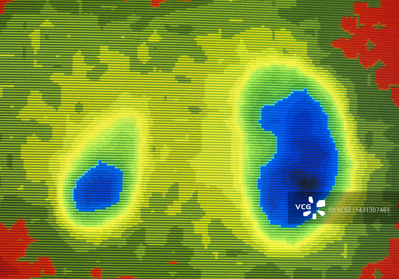 肾功能衰竭的伽玛扫描图片素材