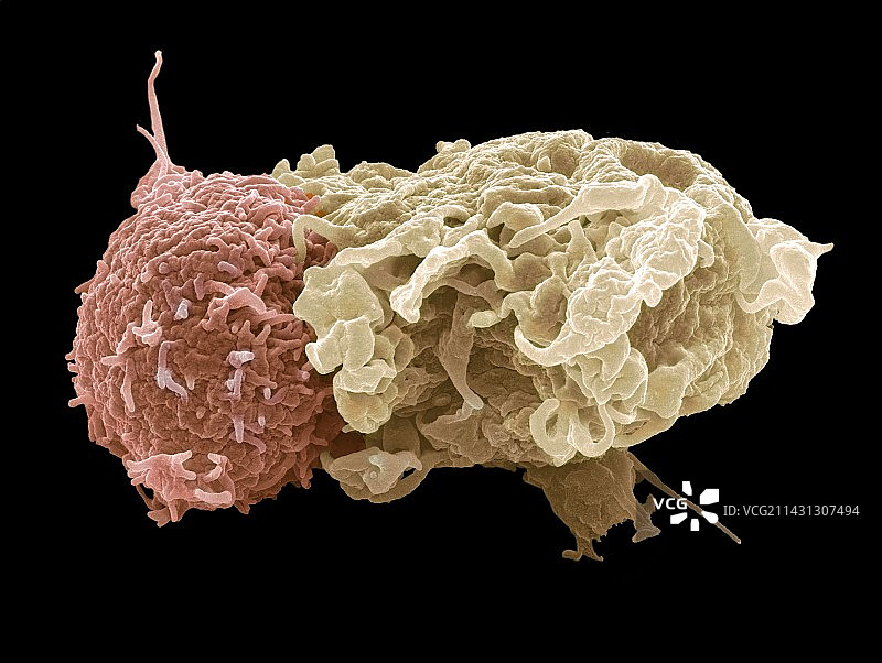 抗原呈递扫描电镜图图片素材