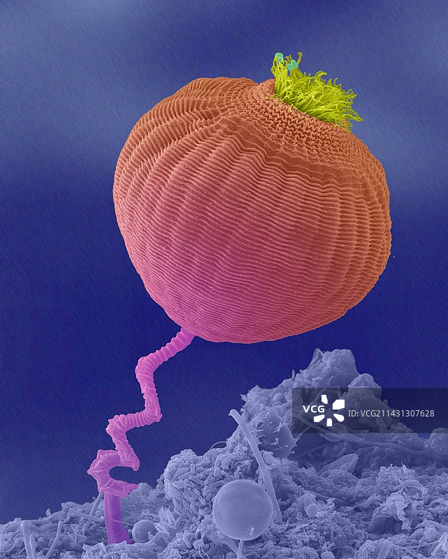 原生动物（钟虫属），扫描电子显微镜图片素材