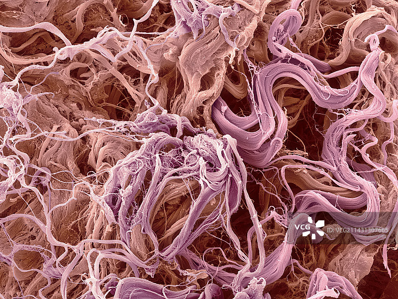 胶原纤维扫描电镜图图片素材